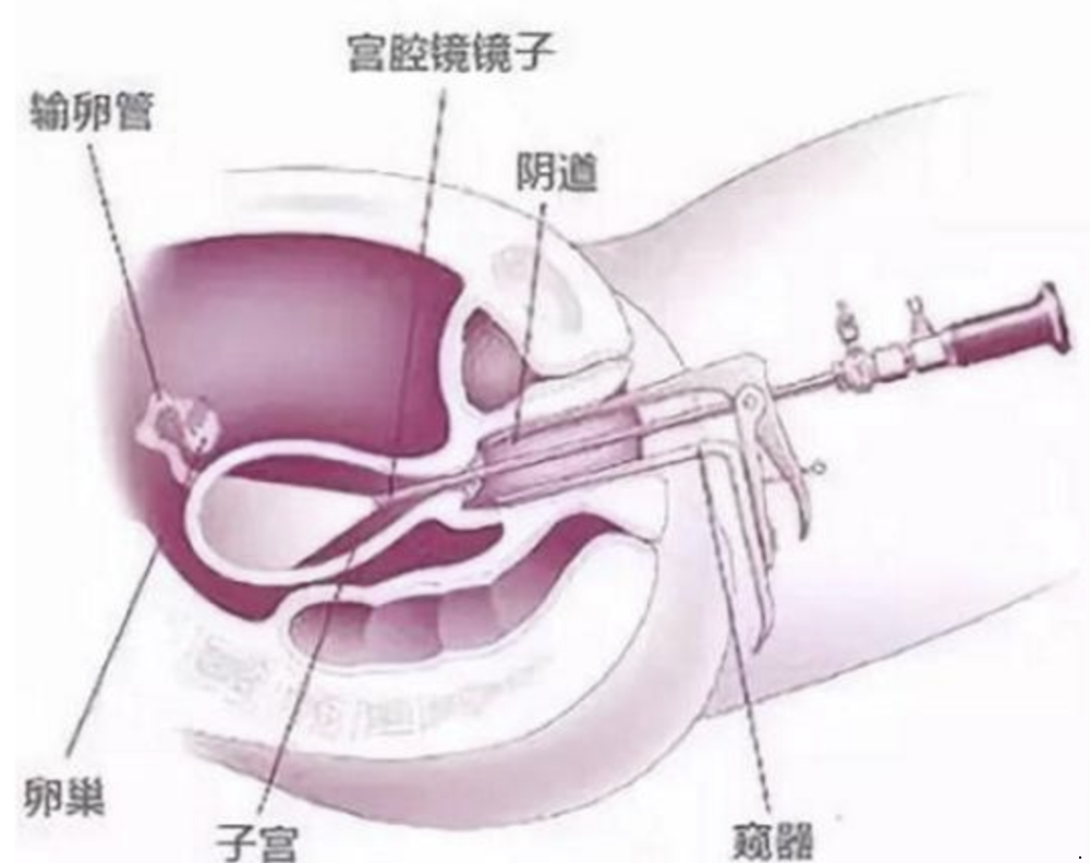 3b3925831271429b8139de8b2d238e6c.png 3b3925831271429b8139de8b2d238e6c.png