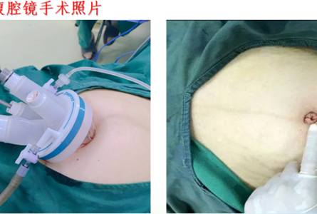妇科：国家中西医协同“旗舰”科室